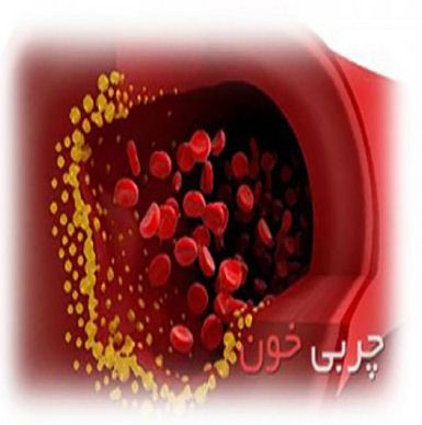 بروشور هیپرلیپدمی رشته پرستاری
